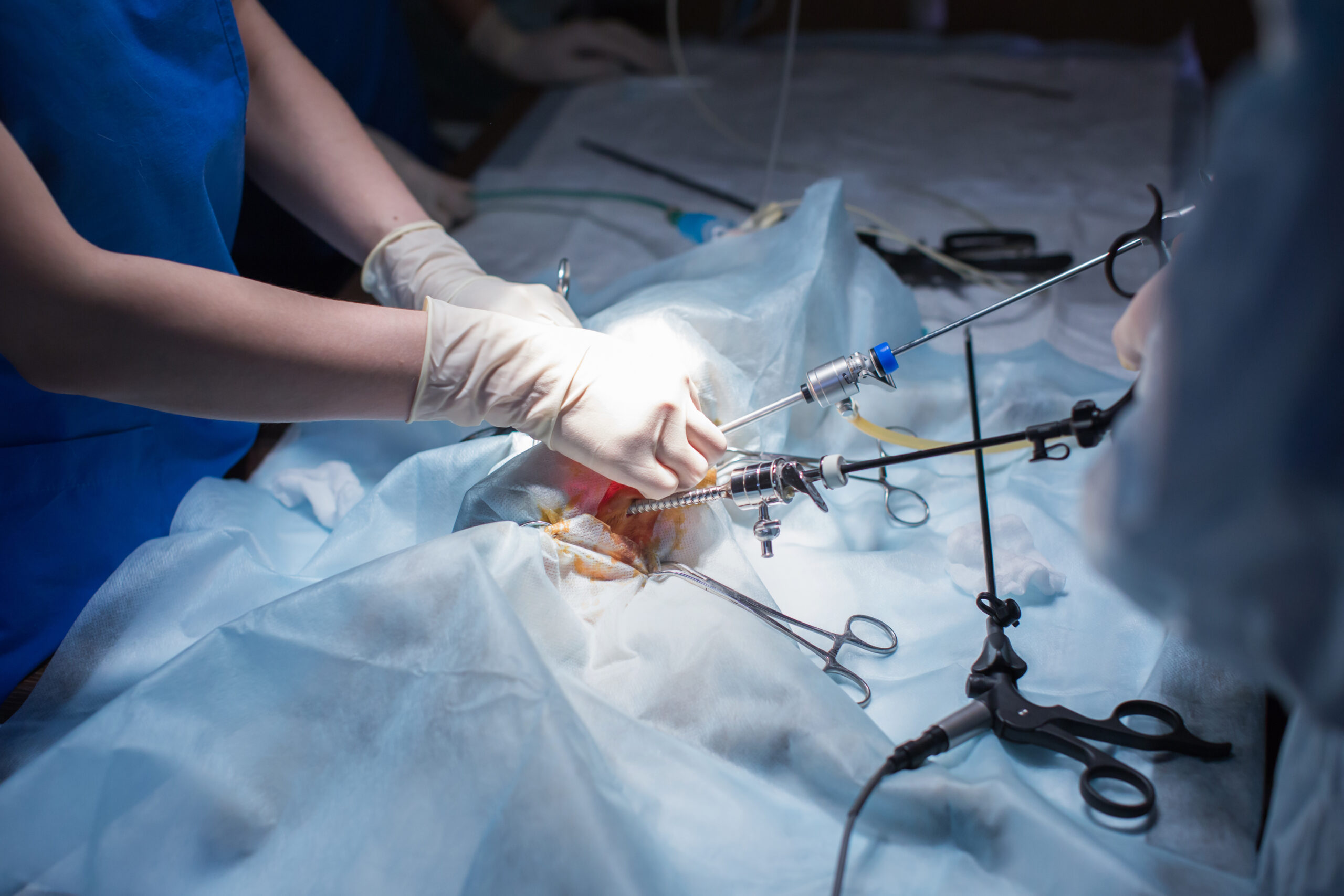 best Laparoscopic Surgeons in Chamrajpet